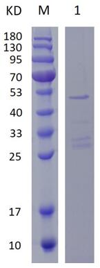 12% SDS-PAGE analysis profiles of purified GST-His-RPA3 (CBB stained).